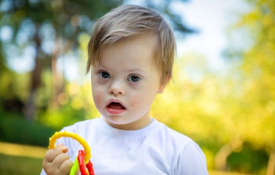 portrait-of-cute-small-boy-with-down-syndrome-2023-11-27-04-56-22-utc
